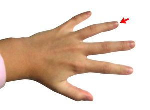 Попробуйте потянуть безымянный палец в течение 20 секунд. Вы будете удивлены!