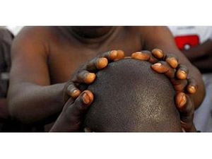 "У лысых в голове золото": жителю Мозамбика отрезали голову из-за суеверия
