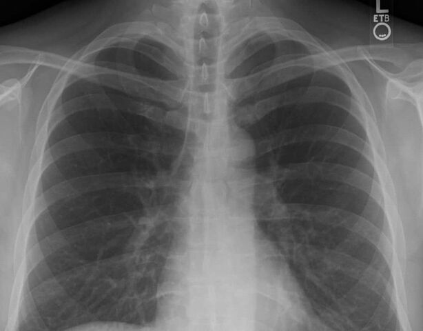 Что умеют легкие: факты о работе дыхательной системы человека