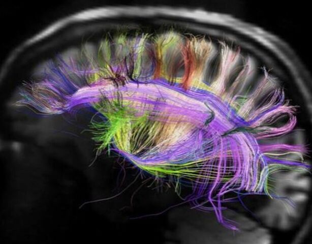 ТОП-10: Странные факты про память, которые вы не знали