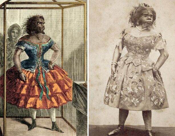 Как сложилась судьба женщины-гориллы, поверившей в любовь