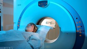 Компьютерная томография повышает риск развития рака головного мозга