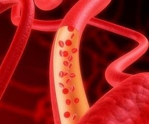 11 несложных способов для улучшения циркуляции крови