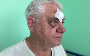 В Харькове коп избил пенсионера за просьбу уступить место в трамвае