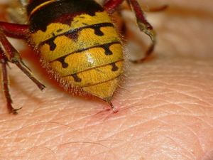 Что делать, если укусила пчела или оса — как оказать первую помощь пострадавшему