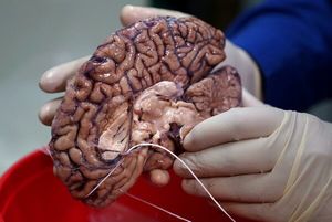 5 фактов о человеческом мозге, которые вас удивят