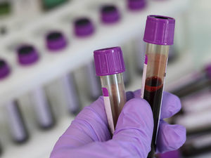 Тесты на антитела к коронавирусу московских врачей дали поразительный результат