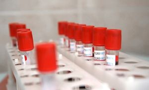В РФПИ допустили начало производства вакцины от COVID-19 в августе