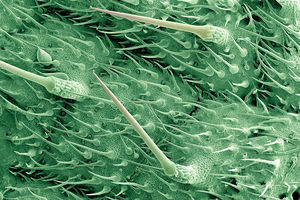 Природный шприц: листья крапивы под микроскопом