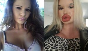 Андреа Иванова:«Я хочу иметь не только самые большие губы в мире, но и самые большие…»
