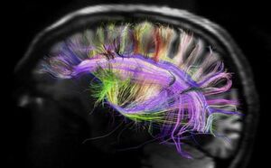 ТОП-10: Странные факты про память, которые вы не знали