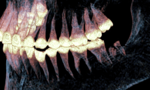 Российские учёные нашли доказательства сложнейшей челюстной операции возрастом 2500 лет