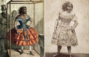 Как сложилась судьба женщины-гориллы, поверившей в любовь