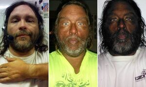 Melanotan II: эксперимент с внешностью и его последствия
