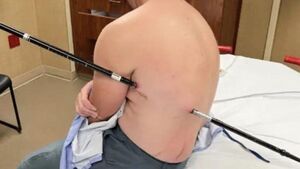 «Родился в рубашке»: невероятная история выживания Дэвида Чифальди