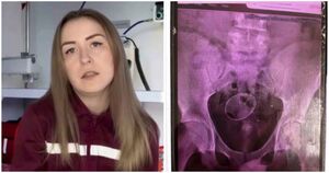 Эксперимент с последствиями: 16-летний подросток попал к врачам из-за сырого яйца