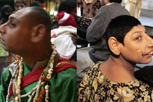 Крысы Шаха Дола