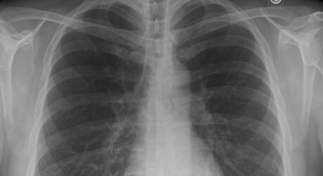 Что умеют легкие: факты о работе дыхательной системы человека