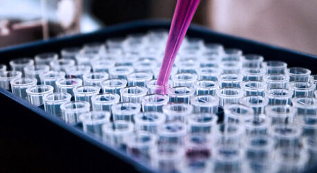 В России стартует клиническое применение нового отечественного препарата для лечения рака