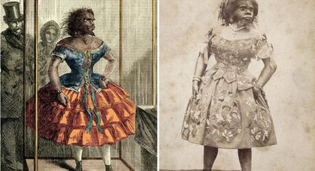 Как сложилась судьба женщины-гориллы, поверившей в любовь